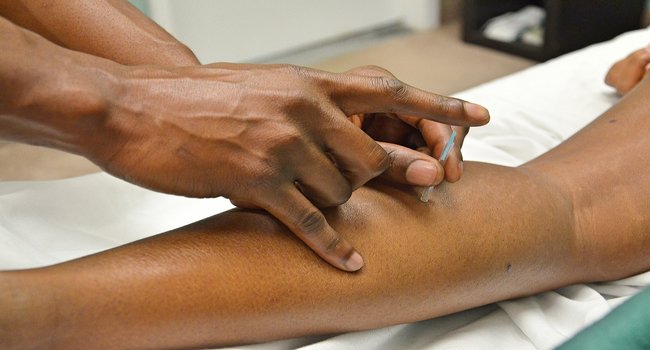 acupuncture heals arthritis